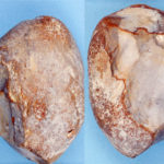 Galets aménagés de silex provenant de Wimereux (Pas de Calais), ©R. Platevoet