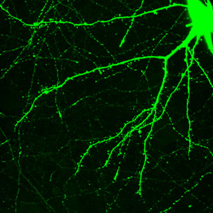 neurone de rat